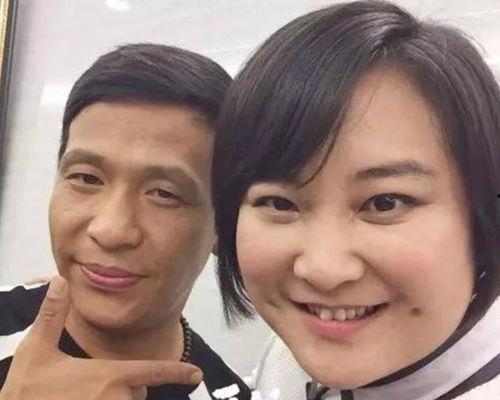 贾玲爆料瘦脸针视频,揭秘明星美容秘密  第1张